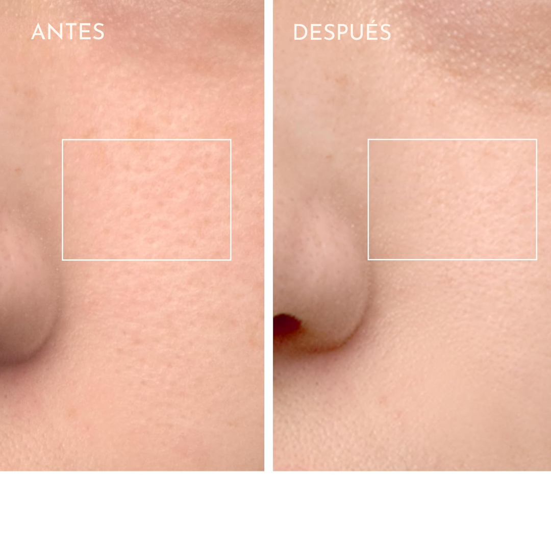 ✨ Electric Sonic Facial Cleanser – Your beauty routine in 60 seconds